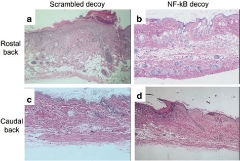 Limited Inhibitory Effects Of NF KB Decoy ODN On Skin Transfected With