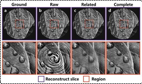 Iucr Deep Learning Based Ring Artifact Correction For Tomographic Reconstruction