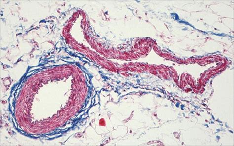 Blood Vessel Cross Section Slide Diagram Quizlet