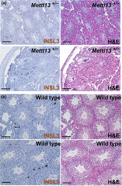 Feat Enhances Insl3 Expression In Testicular Leydig Cells Li 2018