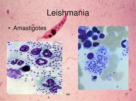 Ppt Leishmania And Leishmaniasis Powerpoint Presentation Free