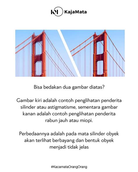 Apa Sih Perbedaan Minus Dan Silinder Kajamata