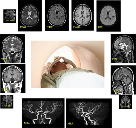 Mri検査のご紹介 Nhoさいがた医療センター