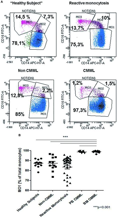 Repartition Of Monocytes Subsets In Different Groups Of Cases Monocyte