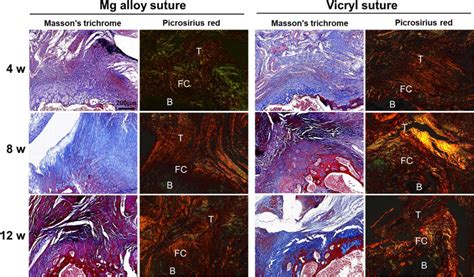 Masson S Trichrome Staining And Picrosirius Red Staining Of Tendon Bone Download Scientific