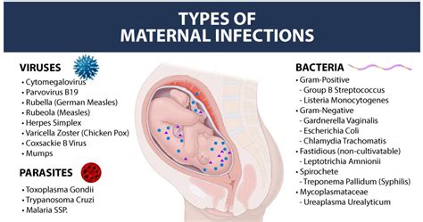 Chorioamnionitis Birth Injury Law Firm