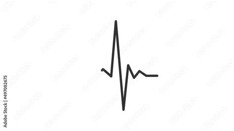 Cardiogram Electrocardiogram EKG ECG Animation | 2D Animated Heartbeat Monitor | Cardiograph ...