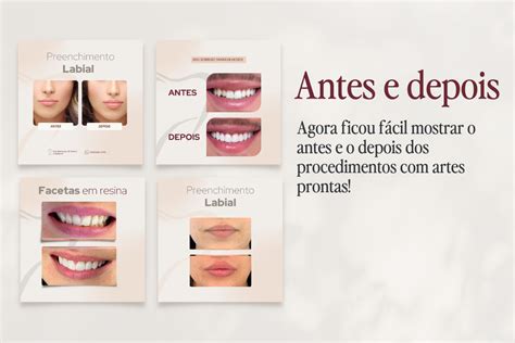 Pack Dentista Mulher Influente Studio Mi Studio