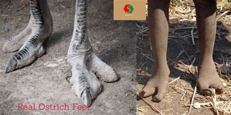 The Ostrich Tribe of Zimbabwe Has a Two-Toed Population Due to a Rare Genetic Condition Which ...