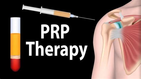 What Is Prp Move Well Md Integrative Medical Center