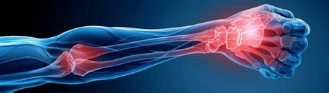 Comprehensive Guide On Causes Symptoms And Treatment Options For Elbow