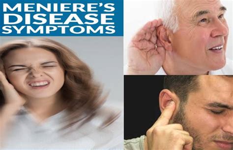 Meniere S Disease Definition Symptoms Causes And More