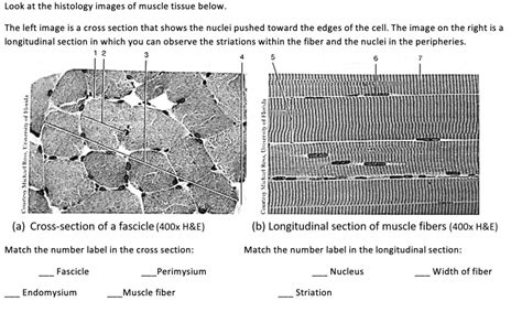 SOLVED: Text: Look at the histology images of muscle tissue below. The left image is a cross ...