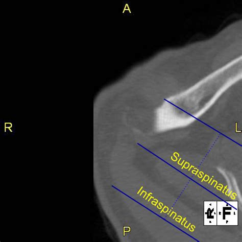 Msk Ct Protocols