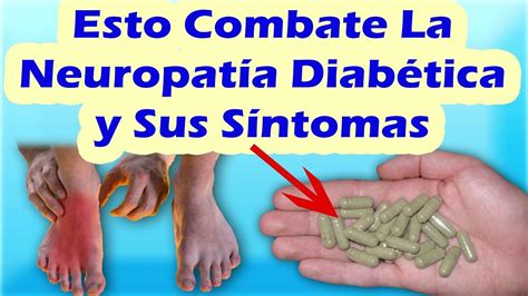 Neuropatía Diabética Tratamiento Natural Remedios Caseros Para La