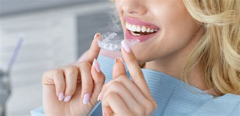 What Is Invisalign How Does It Work And How Long Does It Take