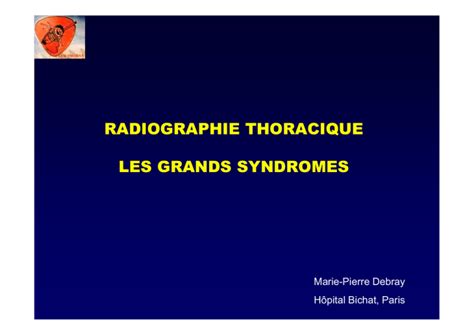 Syndrome Bronchique