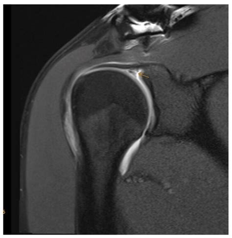 Jcm Free Full Text Current Understanding And New Advances In The Surgical Management Of