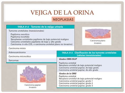 Vias Urinarias Bajas Y Aparato Genital Masculino PPT