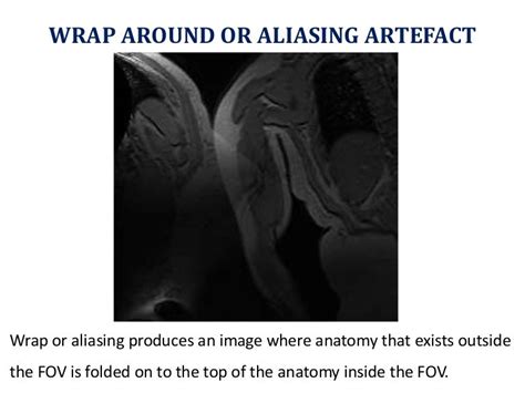 Aliasing Or Wrap Around Artifacts