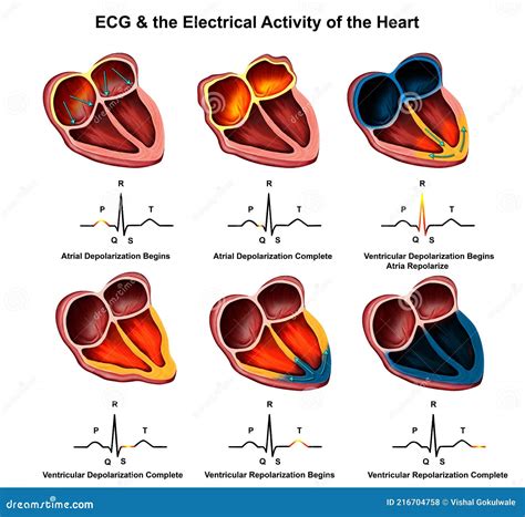 Ecg a Atividade Elétrica Do Coração Ilustração Stock Ilustração de