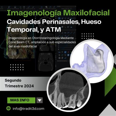 Imagenolog A Maxilofacial Cavidad Perinasales Huevos Temporal Y Atm