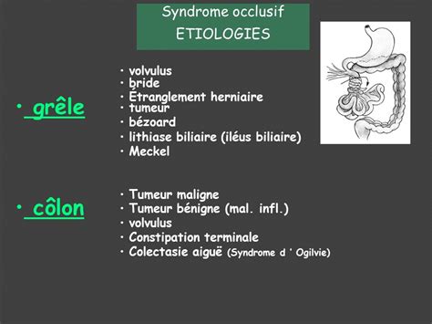 Examen Clinique De Labdomen Principaux Syndromes Ppt Video Online