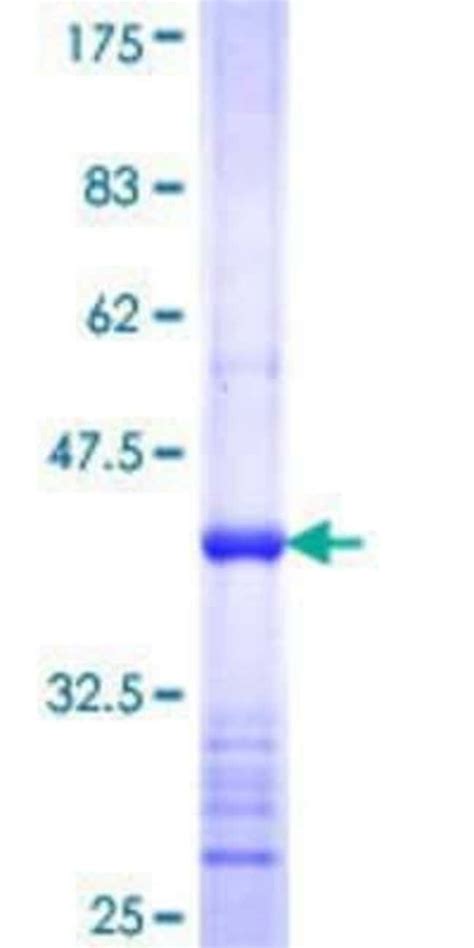 Novus Biologicals Recombinant Human ABR GST N Term Protein 10 μg