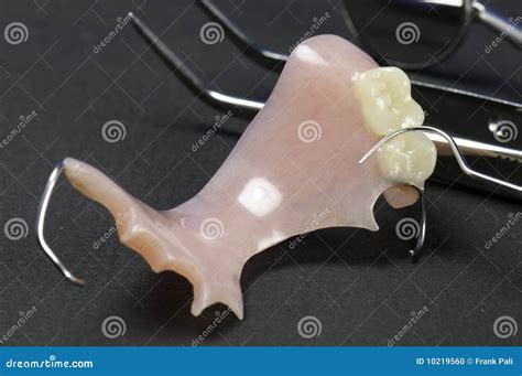 Partial Dental Bridge Stock Photo - Image: 10219560