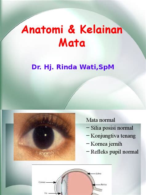 Anatomi Dan Kelainan Mata Pdf