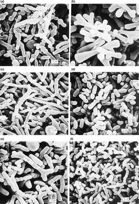 Cellular morphology of different species of Bifidobacterium: (a) B ...