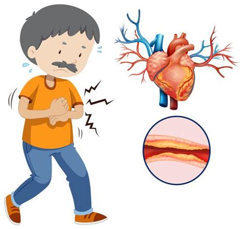 Cardiovascular Disease Vector Art Icons And Graphics For Free Download