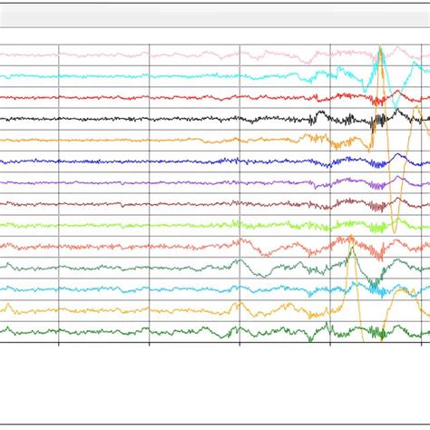 10 20 Map Of Eeg Electrodes Download Scientific Diagram