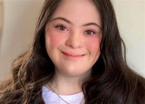 Model With Down Syndrome Ellie Goldstein Doesn T Want Pics Airbrushed