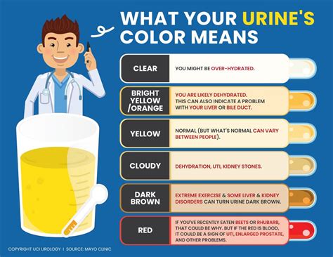 Urology Infographic What Your Urines Color Means Scaled MCESDA