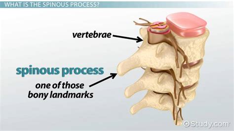 Spinous Process: Function & Fracture Treatment - Video & Lesson ...