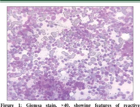 Figure 1 From A CASE REPORT ON UNICENTRIC FORM OF CASTLEMANS DISEASE