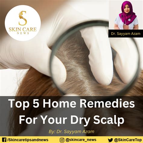 Top 5 Home Remedies For Your Dry Scalp