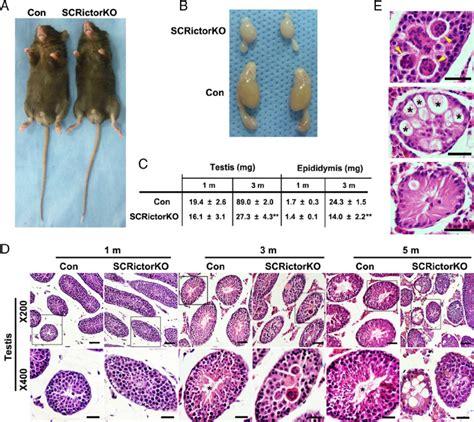 Severe Developmental Defects In Testes And Seminiferous Tubules In