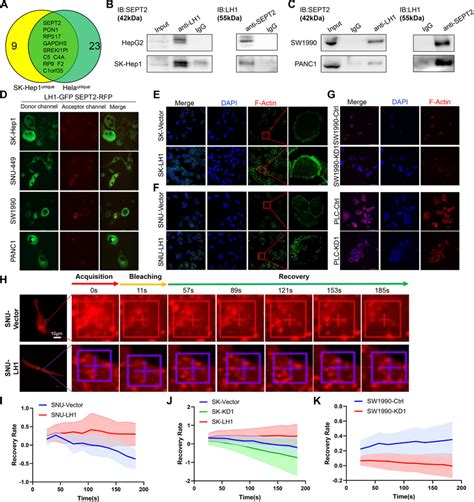 LH1 Binds With SEPT2 And Enhances Actin Polymerization A Venn Diagram