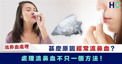 【流鼻血處理】甚麼原因經常流鼻血？處理流鼻血不只一個方法！ Health Concept