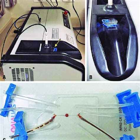 Application Of Magnetic Hyperthermia To Glioblastoma On A Chip A