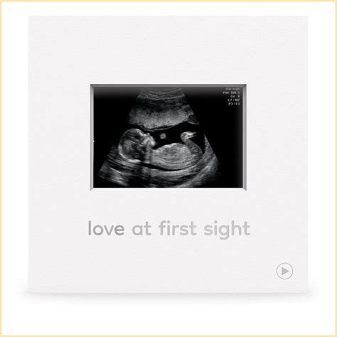 Ultrasound Audio Voice Recorder And Baby Sonogram Picture Frame Love At