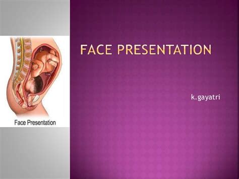 Face presentation