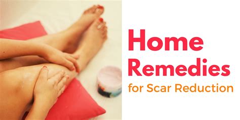 Home Remedies For Scar Reduction — Atlantic Health Solutions