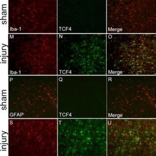 Double Immunofluorescence Staining Of TCF4 And Different Cell Specific