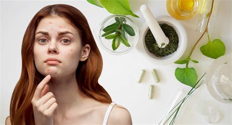 Top Ayurvedic Therapies To Cure Acne Pimples Sure Shot Ayurveda