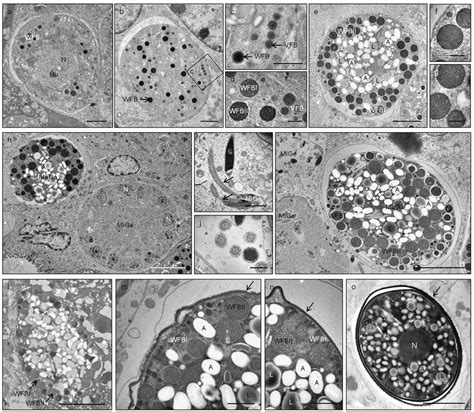 Transmission Electron Microscopy Tem Images Of Developing And Mature