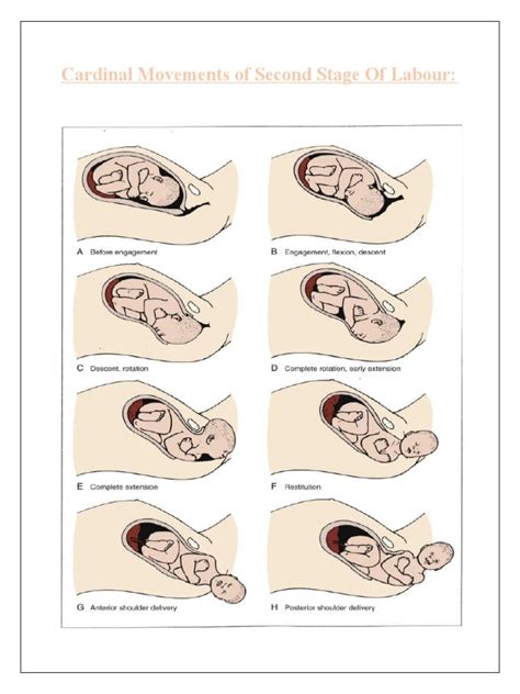 Cardinal Movements Of Second Stage Of Labour Pdf