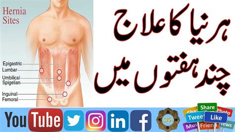 Hernia Ka Bgair Opration Ilaj In Urdu Treatment Of Hernia TIB E